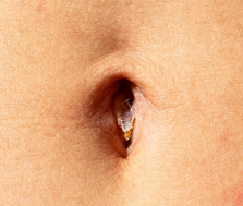 Bellybutton